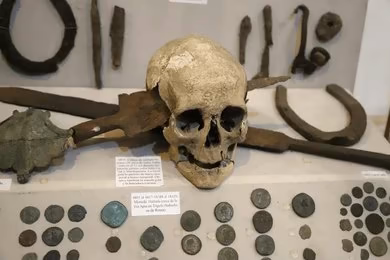 Forensic Anthropology: Skeletal Analysis